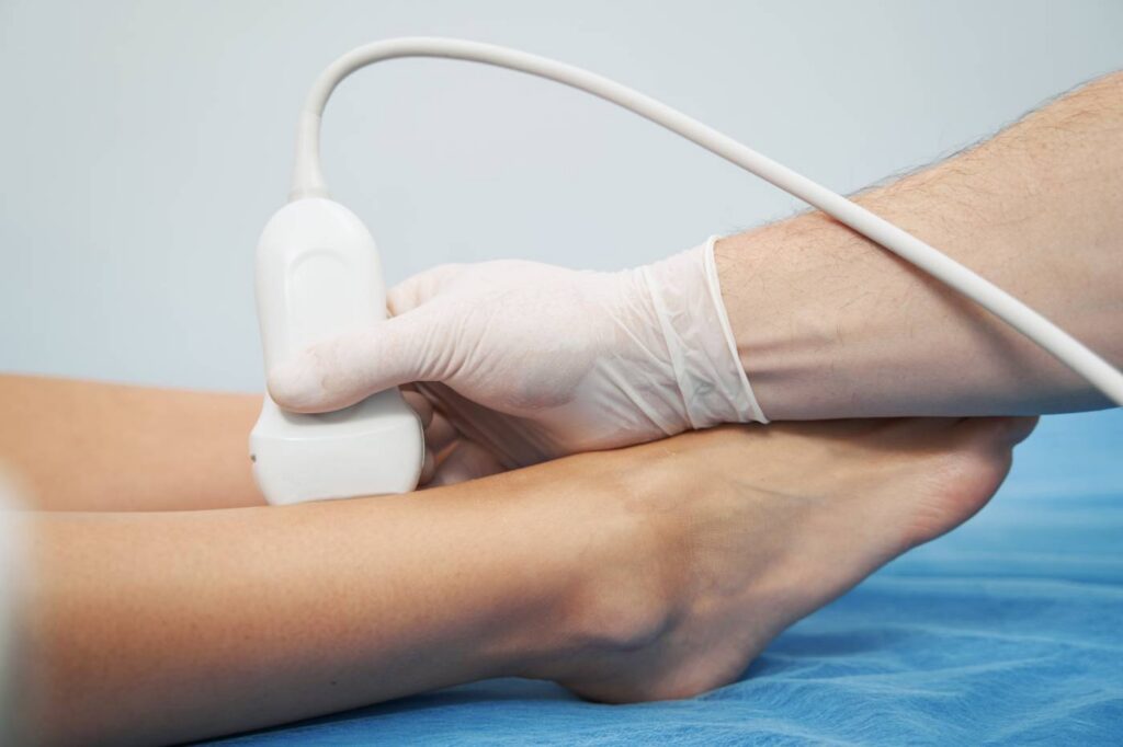 Diabetic Feet