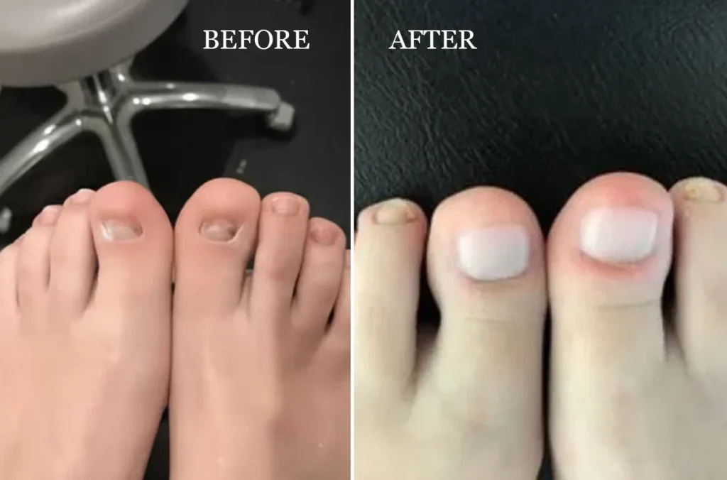 before after