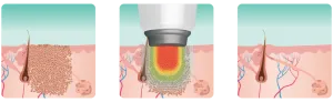 figure 1 2 3 1024x313 1 300x92 1